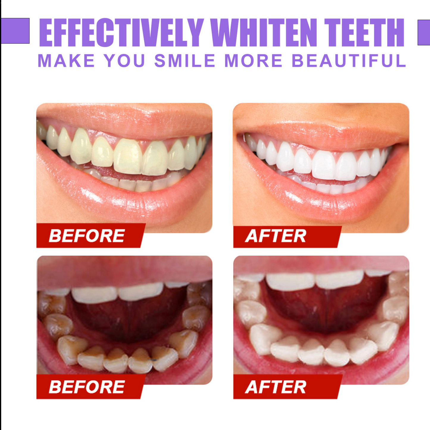 Dentifrice glorysmile