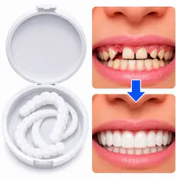 Facettes adaptables