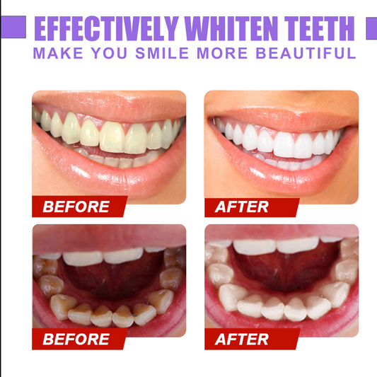 Dentifrice glorysmile