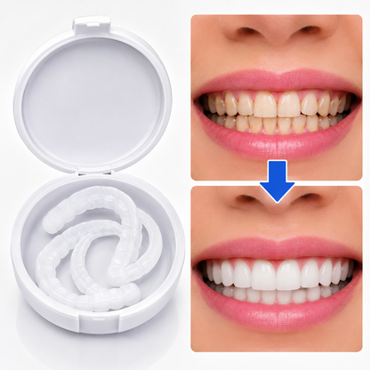 Facettes adaptables